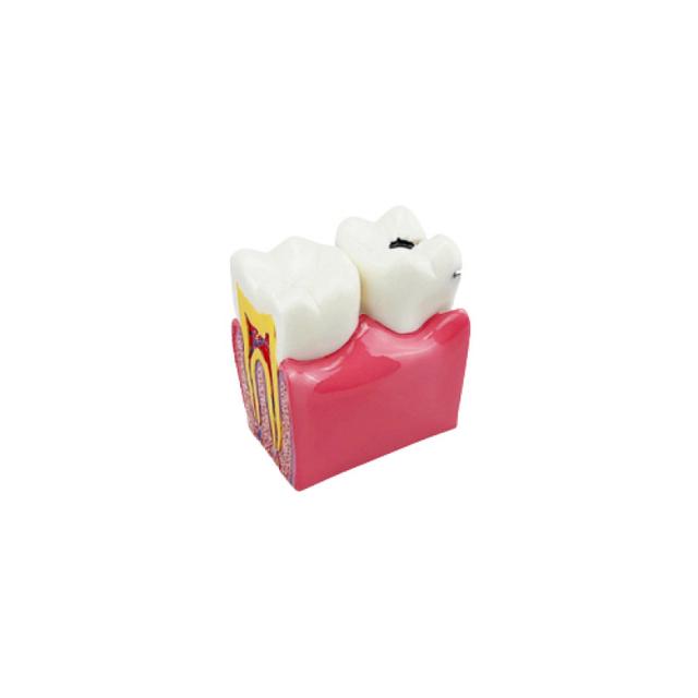 6 Times Anatomy Molar Model