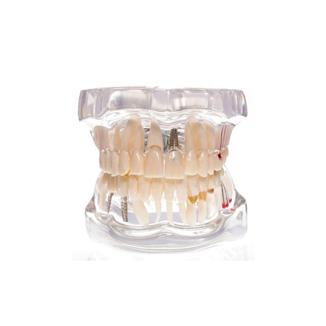 Clear Articulated Typodont