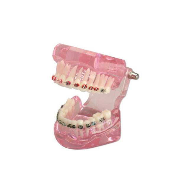 Hager & Werken - Study Model Ortho-Brackets